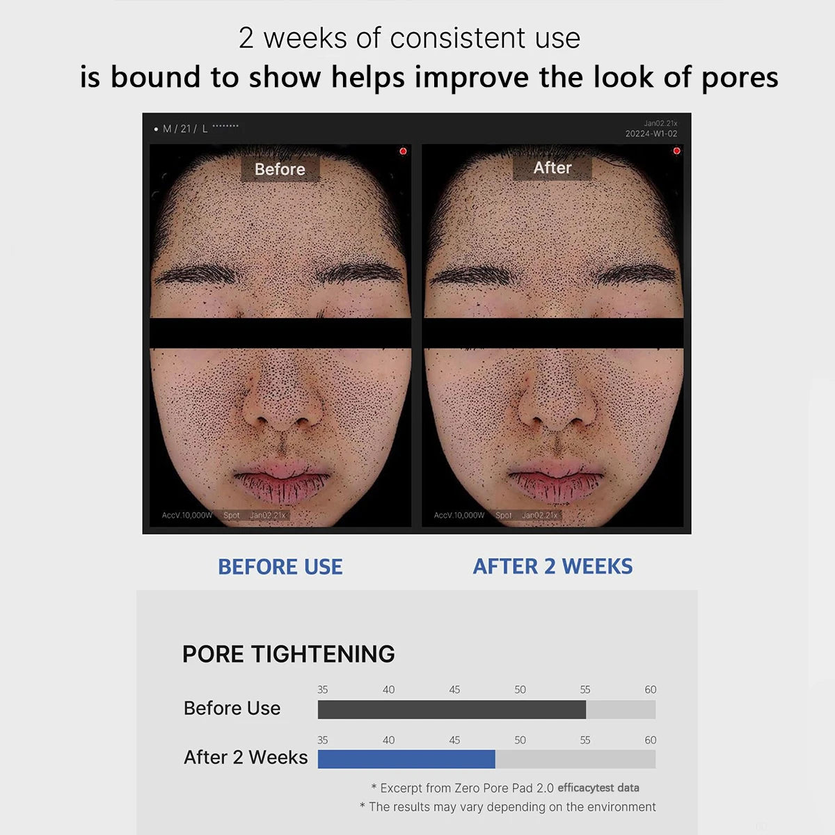 Zero Pore Rescue Pads